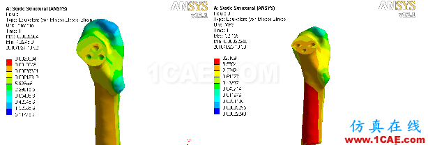 “倒品字”與“品字”空心釘不同Pauwels分型骨折的生物力學(xué)性能研討ansys分析圖片5