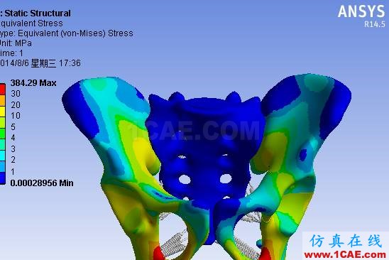 【醫(yī)學(xué)應(yīng)用】骨科知識(shí)和有限元分析ansys分析圖片2